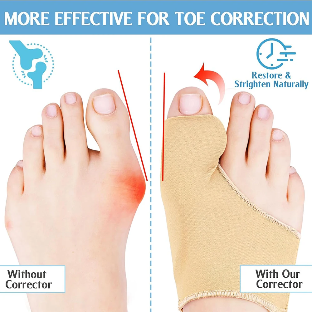 Hallux Valgus Corrector Bunion Corrector Halux Valgus Corrector Bunions Corrector For Women Toe Separator Foot Finger Separators