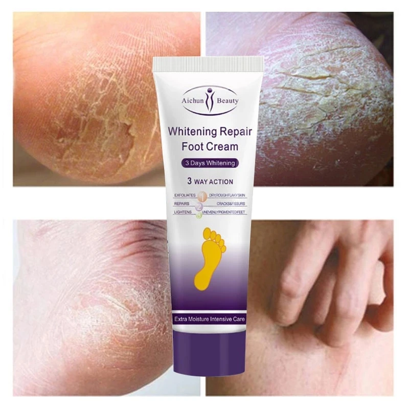 

Foot Care Cream Whitening Anti-Cracking Moisturizing Exfoliating Scrub Anti-Drying Squalane Chamomile Serum Foot Repair 100ml