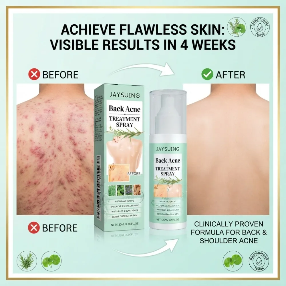 120ml Herbal Back Shoulder Soothing Spray Refreshing Mist Smooth Bumpy Skin Sensitive Skin Friendly Daily Body Care Lotion - view 4