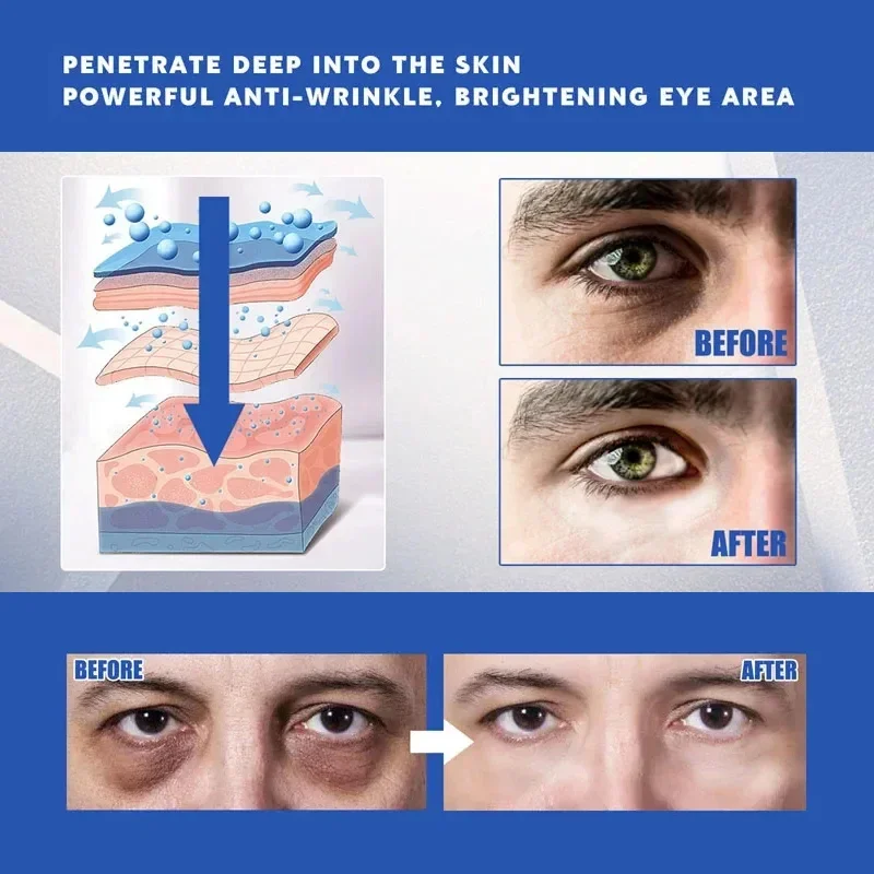 Uomini retinolo crema per gli occhi antirughe sbiadisce linee sottili sollevamento rassodante Anti occhiaie rimuovi borse per gli occhi illumina la cura idratante