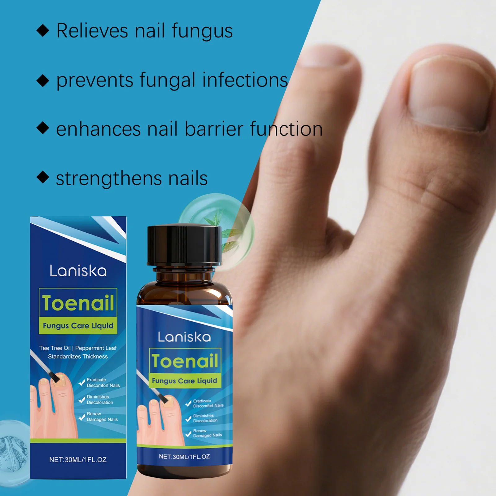 น้ำยาสำหรับรักษาเชื้อราที่เล็บเท้าขนาด 30 มล. ส่วนผสมจากธรรมชาติที่อ่อนโยน น้ำยาป้องกันเชื้อราที่เล็บสำหรับซ่อมแซมเล็บ