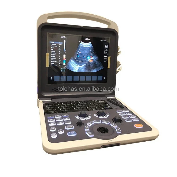 LHK2 Cheapest Portable Color Ultrasound Machine Hospital Prices of Ultrasound Machine 3D ultrasound machine price