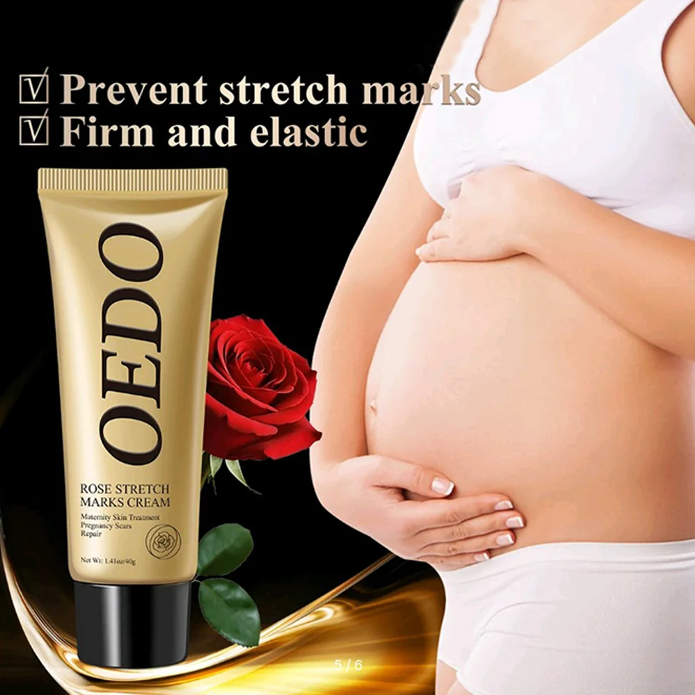 Rose Remove Stretch Marks Cream Anti Wrinkle Anti Aging Maternity Skin Repair Remove Pregnancy Scars Treatment Body Skin Care