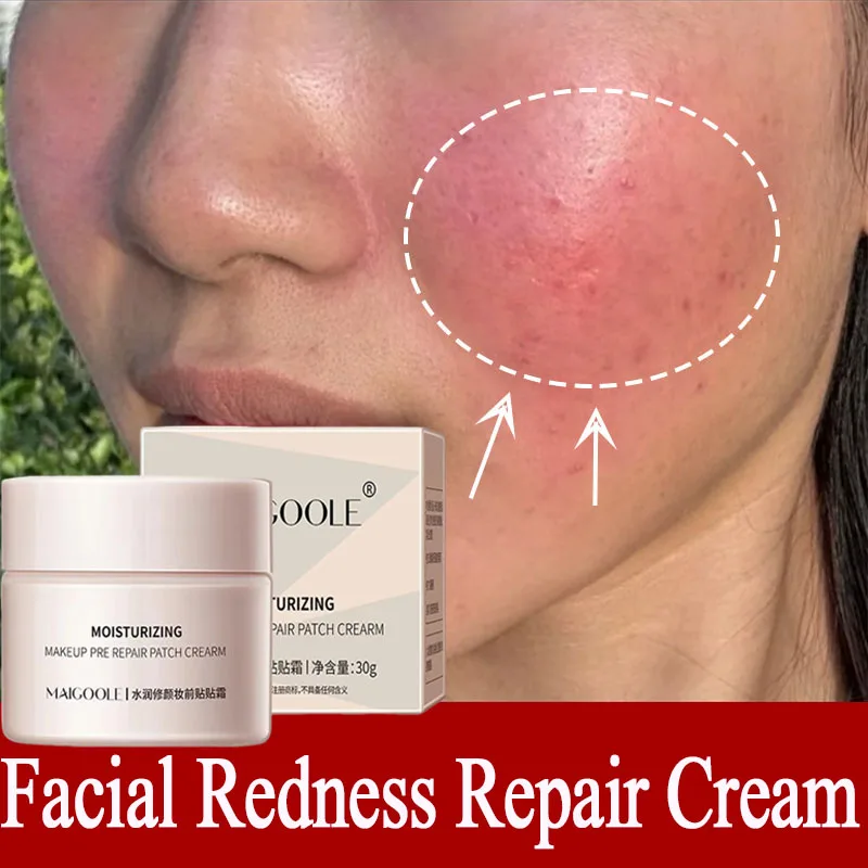 

Facial Redness Repair Cream Improve Sensitive Skin Dryness Moisturizer Hydrating Sooth Lotion Removal Rosacea Korean Cosmetics