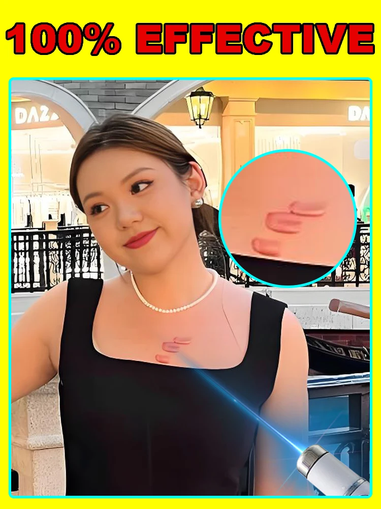 

Недавно модернизированный инструмент для удаления и ухода за шрамами, глобальный бестселлер, 99% Сон azi.