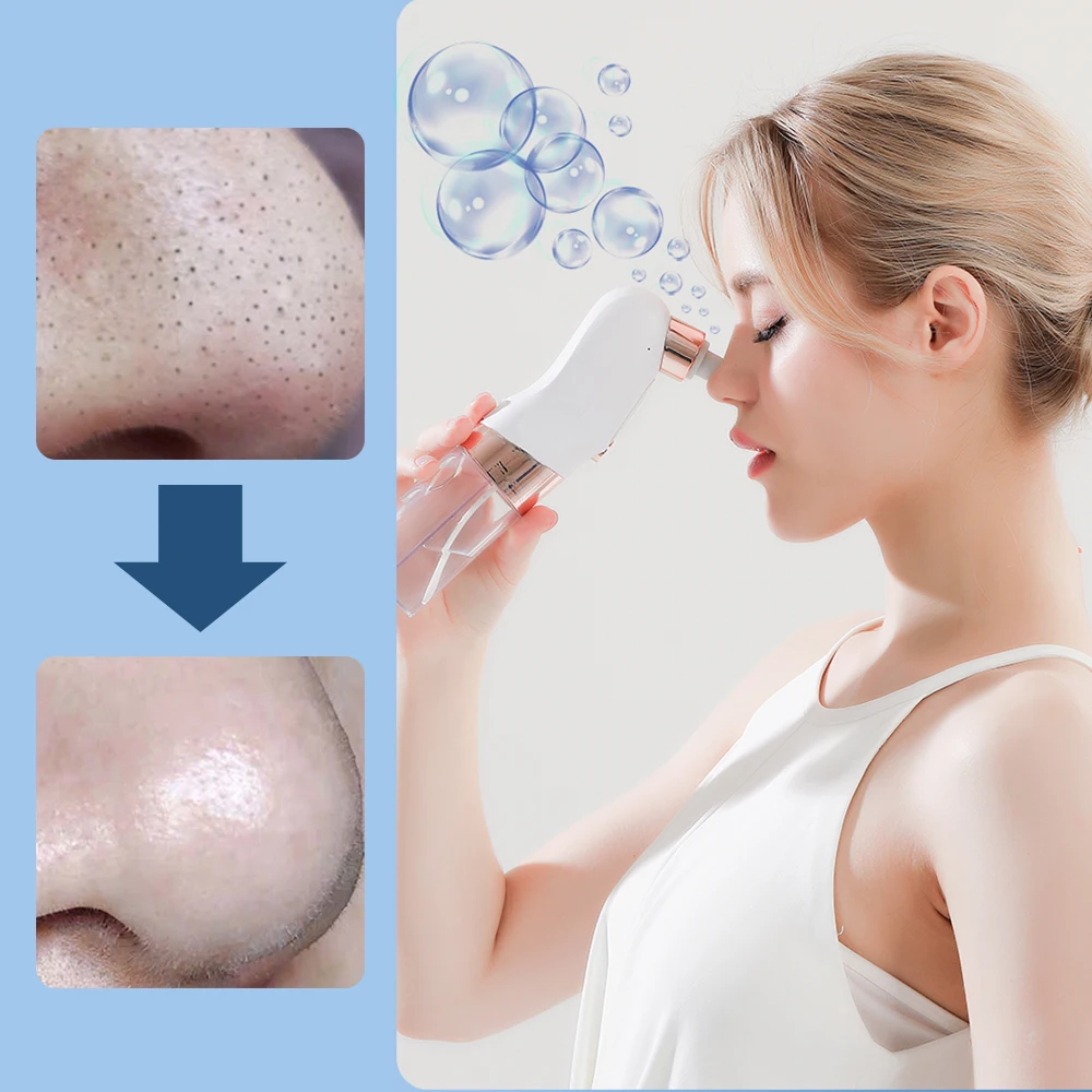 Blackhead Remover Pore สูญญากาศทําความสะอาดใบหน้าไฟฟ้าสิวสิว Black Head Removal Water Cycle Black Dot Remover ชาร์จ USB