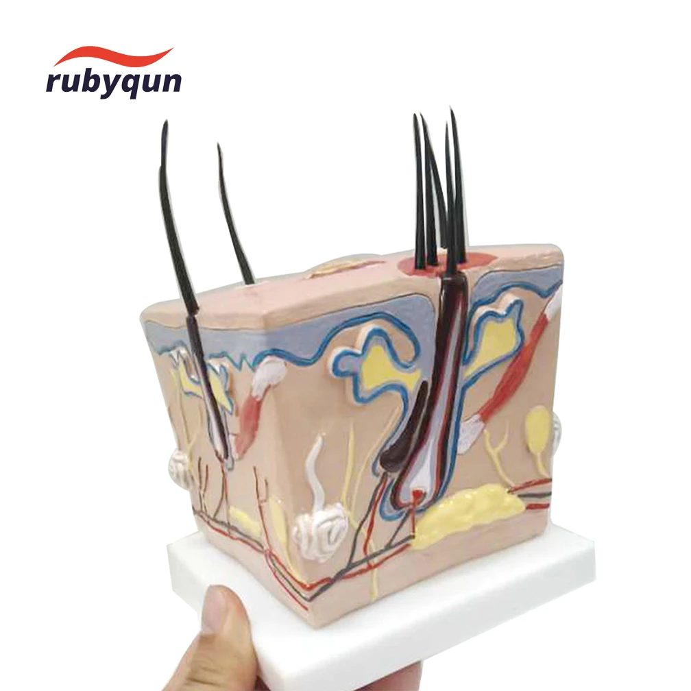 인간 두피 탈모 모델, 모발 이식 모낭 염증 모세 혈관 신경 교육 학습 연구 모델 도구 세트