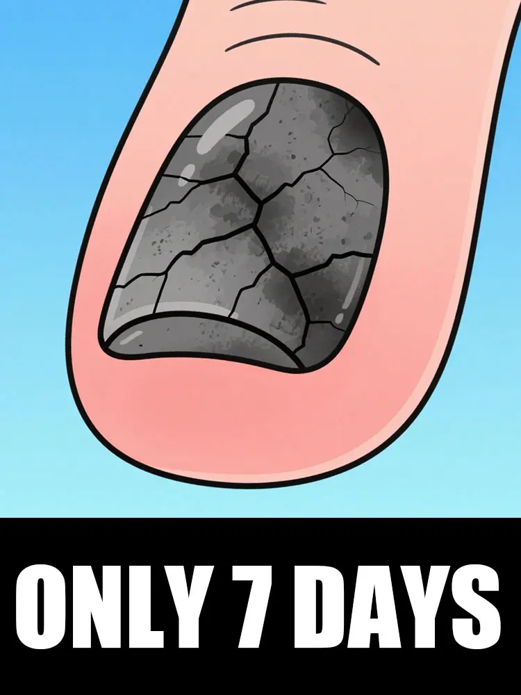 Nagelreinigingshulpmiddel, nail art stickers, vaarwel nagelproblemen