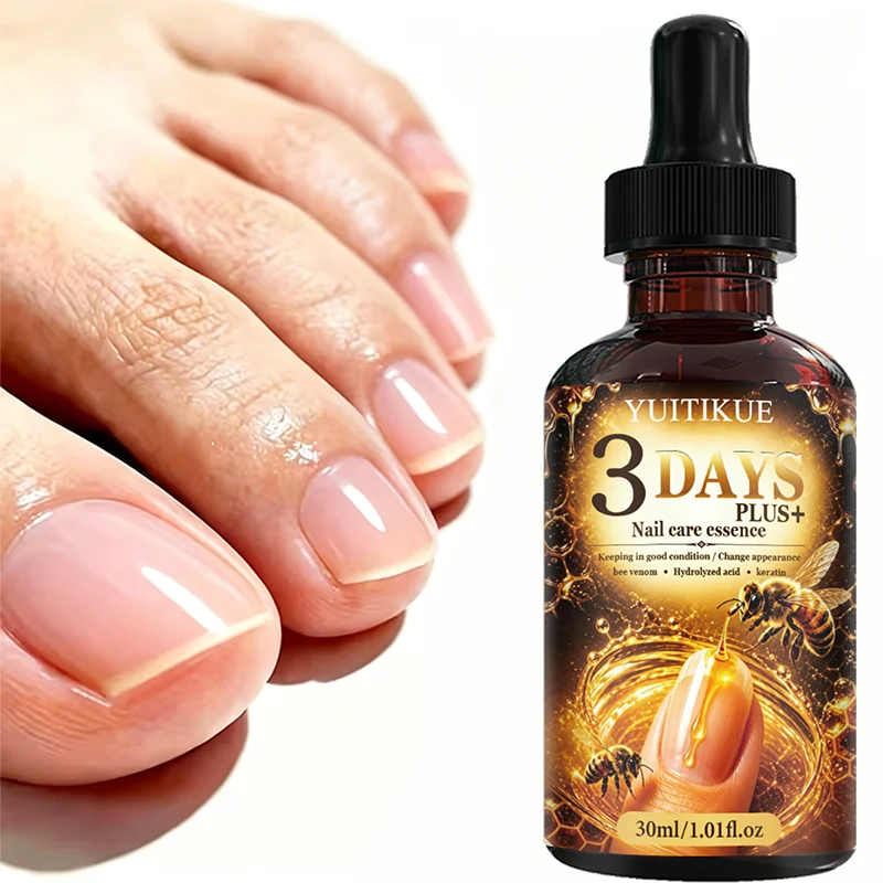 YUITIKUE Bee Venom Keratin Nail Care Essence Deep Hydration Strengthen Weak Cracked Fingernails Toenails Daily Repair Liquid