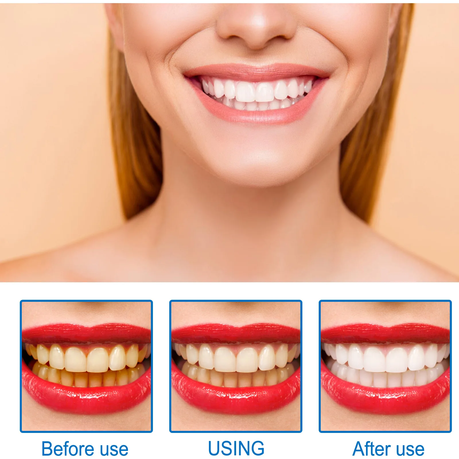 Soro de clareamento dental eficaz, removedor de manchas de placa, remoção de manchas de dente amarelo, hálito fresco, limpeza dental oral, cuidados de branqueamento