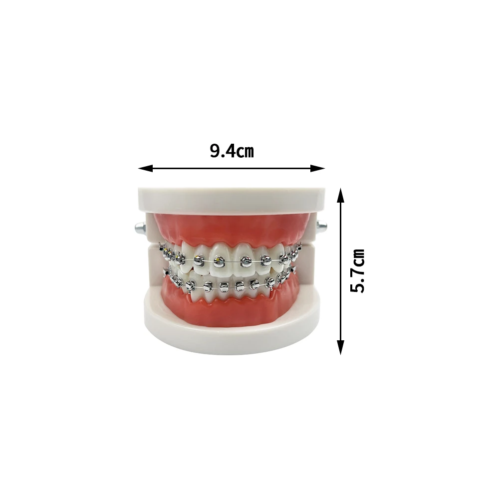 1Pcs Dental Orthodontic Teeth Model With Metal Brackets Self-lock Model Typodont Dentist Teaching Study Demonstration Model