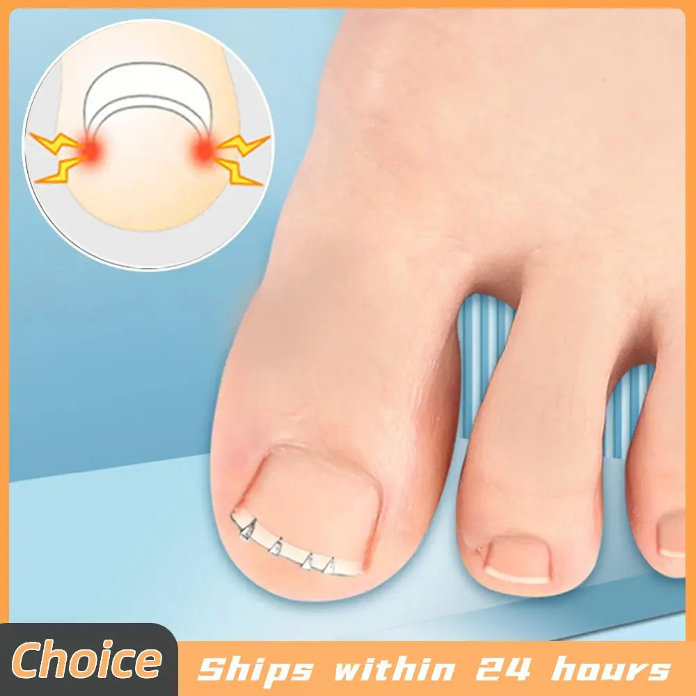 Ingrown Toenail Cor…