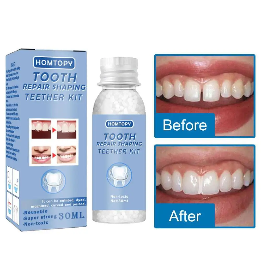 Teeth Repair Glue 30ml for Fixing The Missing and Broken Tooth Replacements Temporary Moldable False Teeth Dental Repair Kit