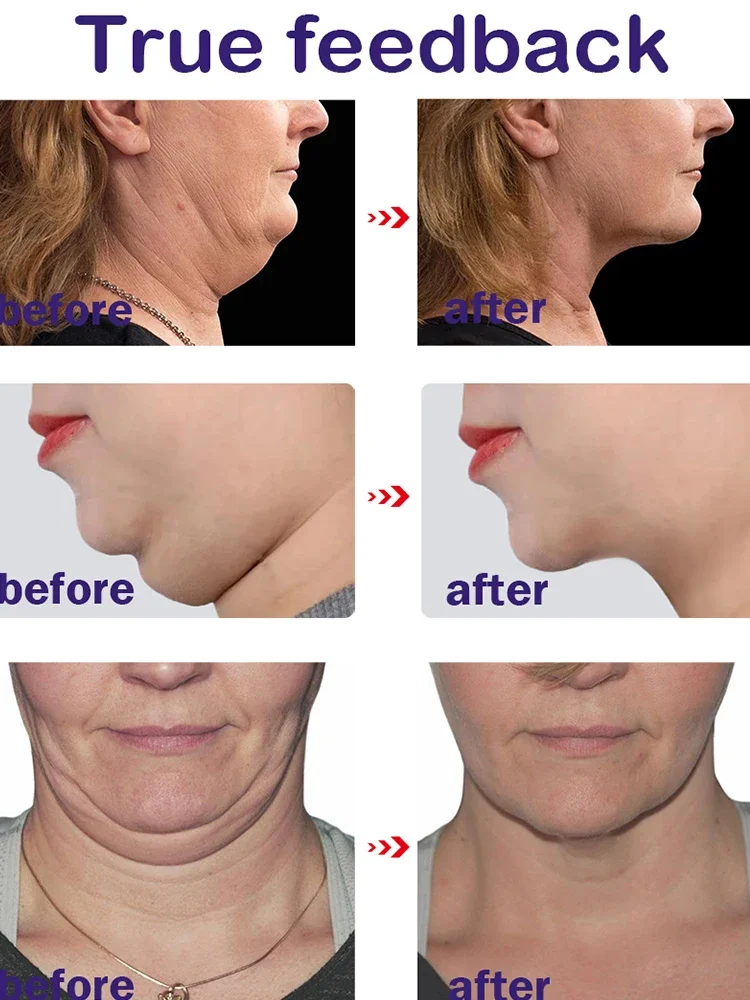 Firming Face-lift Slimming Cream V-Shape Slimming Removal Masseter Muscle Double Chin Face Fat Burning Anti-aging Products