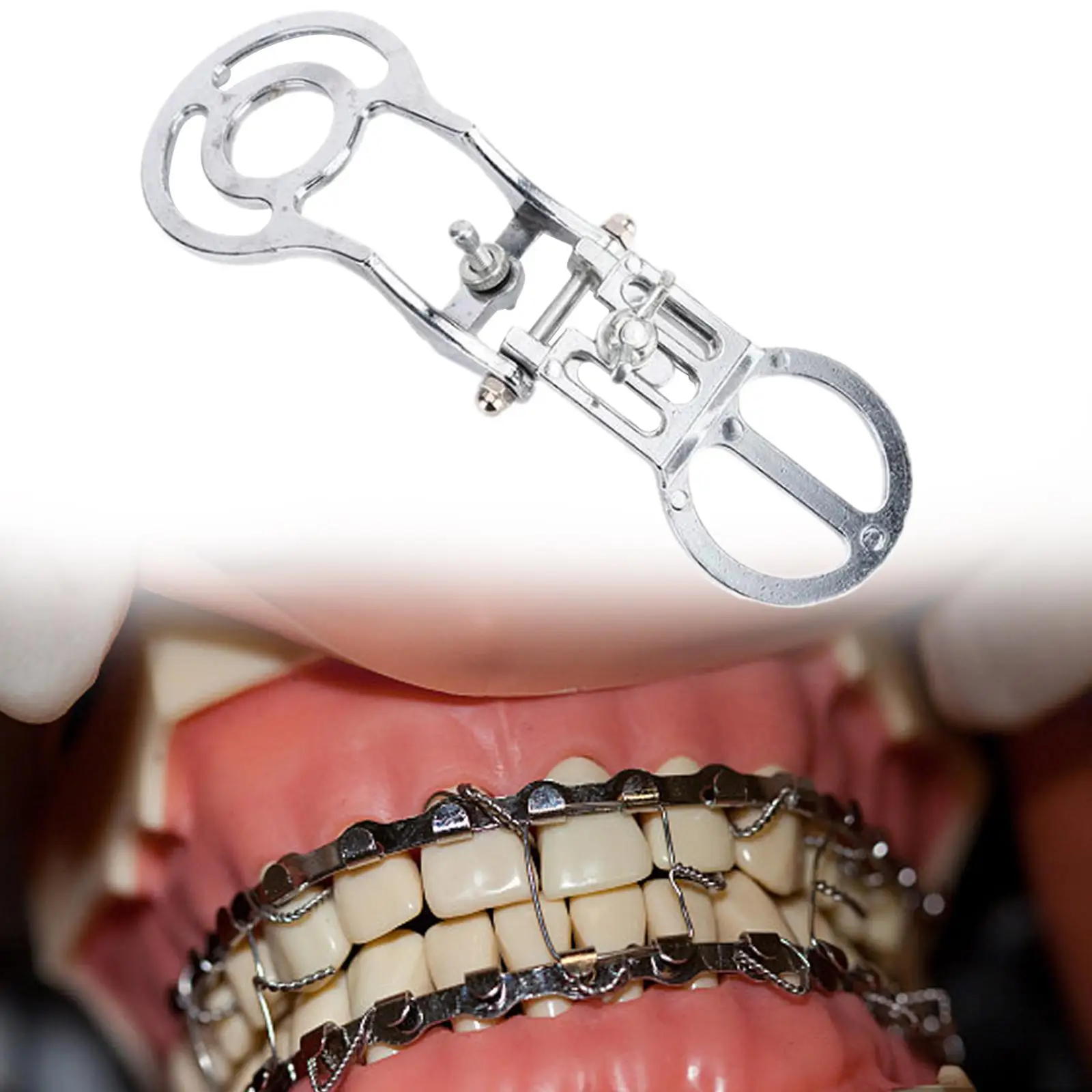 Rak oklusi nampan gigitan tunggal dapat ditekuk Occlusal Orthodontic bingkai kausal