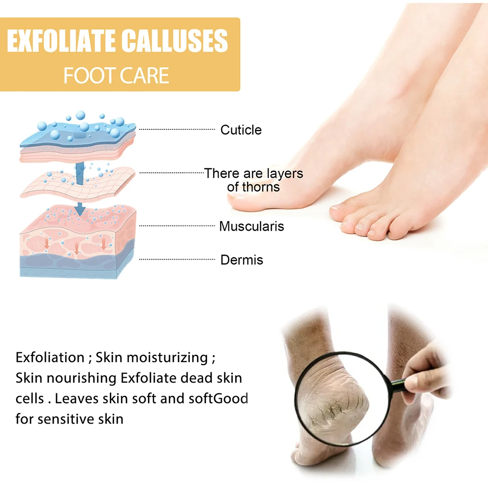 Foot Exfoliating Repair Brightening Spray Anti-Drying Crack Peeling Treatment Removal Dead Skin Calluses Feet Nursing Tools