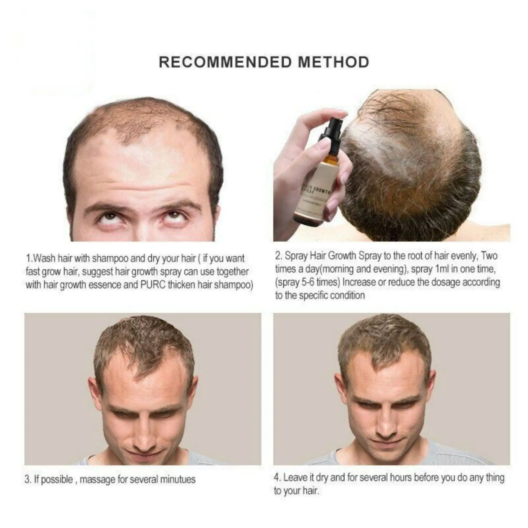 Hair Growth Spray Extract Prevent Hair Loss Growing Hair for Men Professional Brazilian Keratin Spray Growth for Men