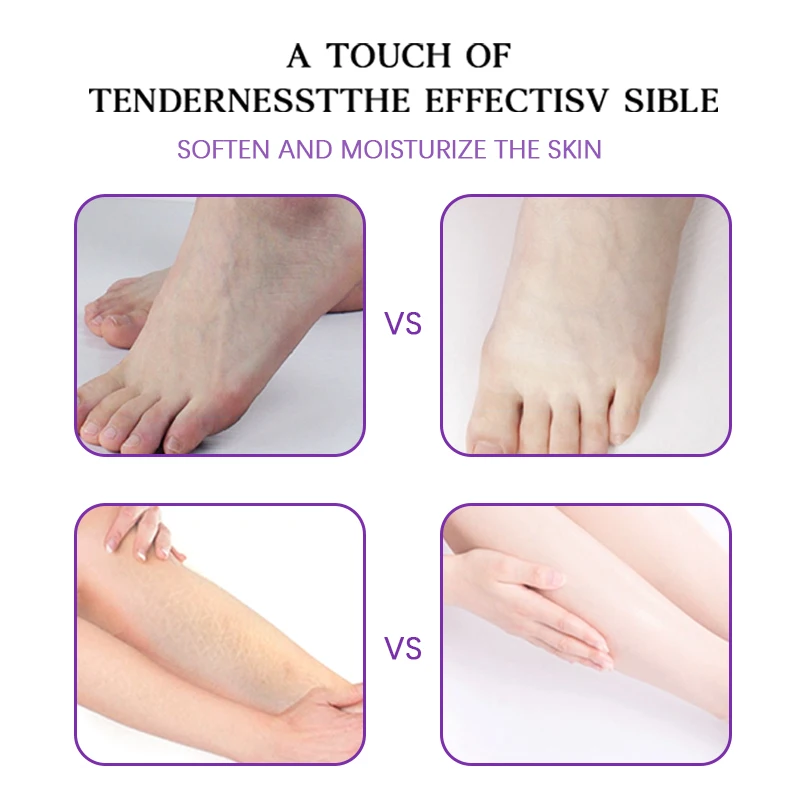 Lavender Foot Cream  Rescues Cracked Feet Nourish And Hydrate Your Dry Rough Feet&Heel,Make Your Skin Smooth And Soft
