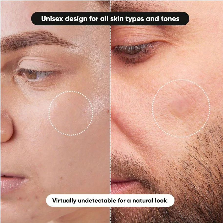 144/360PCS 하이드로콜로이드 투명 원형 여드름 패치, 여드름 및 잡티용 투명 고품질 여드름 패치, 빠르게 흡수