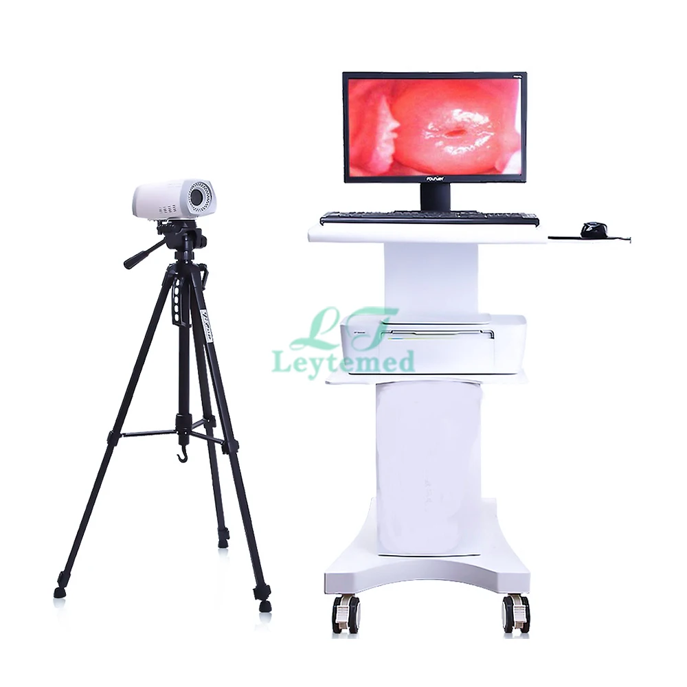 

LTEC03 Low Cost Gynecology Electronic Optical Digital Portable Colposcope Price With Trolley