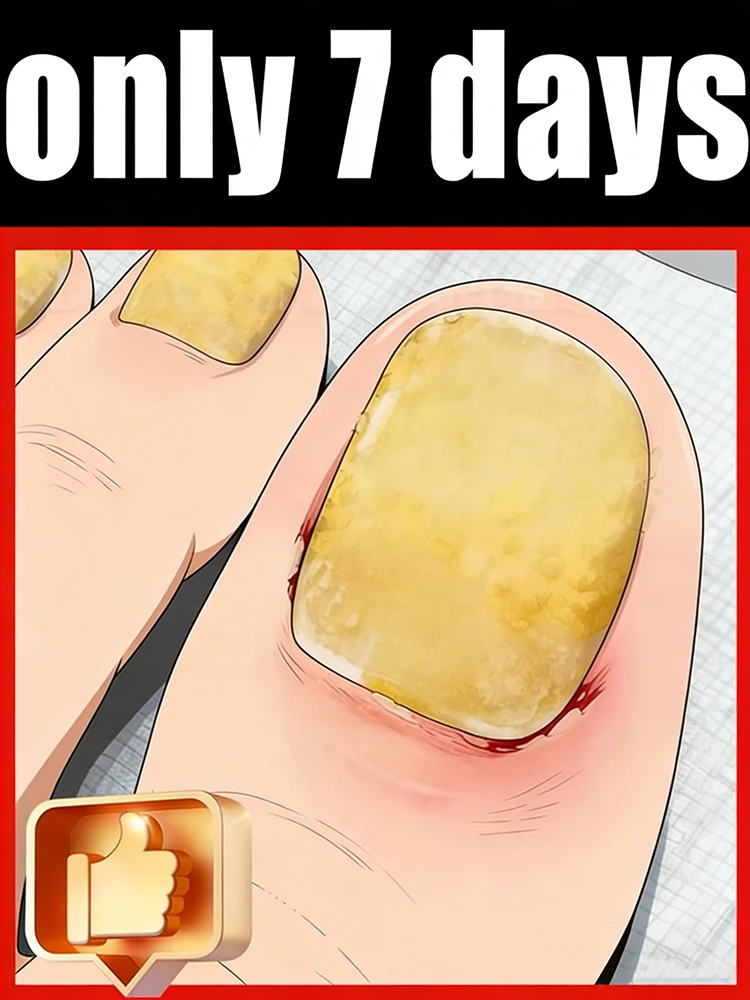 

Quick Penetrating Care, Glassy-Transparent Nails