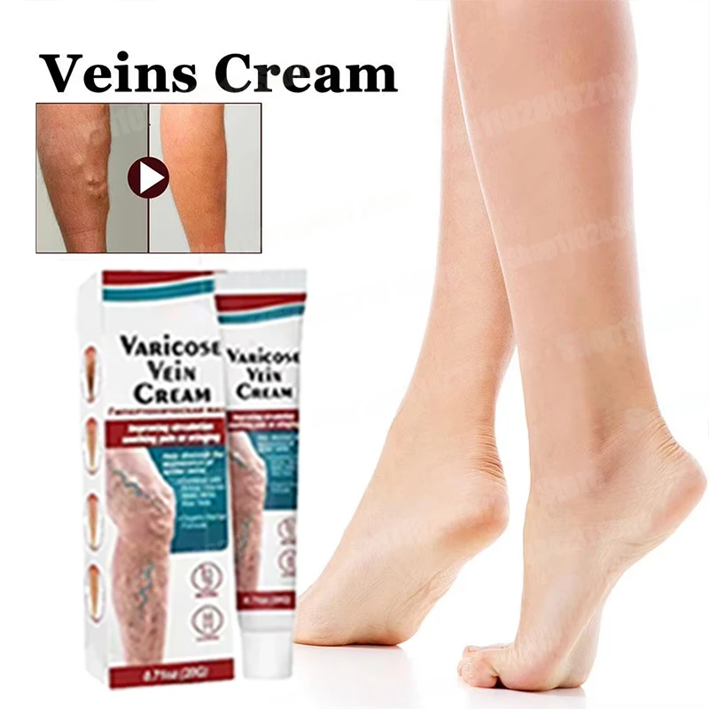 Varicose Vein Cream Spider Vein Pain Cream