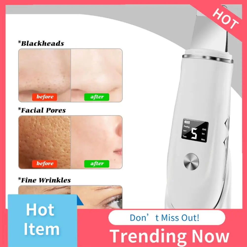 เครื่องขัดผิวหน้าอัลตราโซนิก 24 ชั่วโมง ยกกระชับผิวหน้า ขจัดเซลล์ผิวที่ตายแล้ว ทำความสะอาดผิวหน้าอย่างล้ำลึก