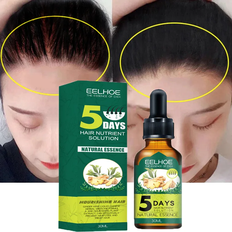 Aceite Anti Alopecia para el crecimiento rápido del cabello, suero esencial de jengibre, sin pelo, aumento de línea alta del cabello, crema de esencia para la cabeza