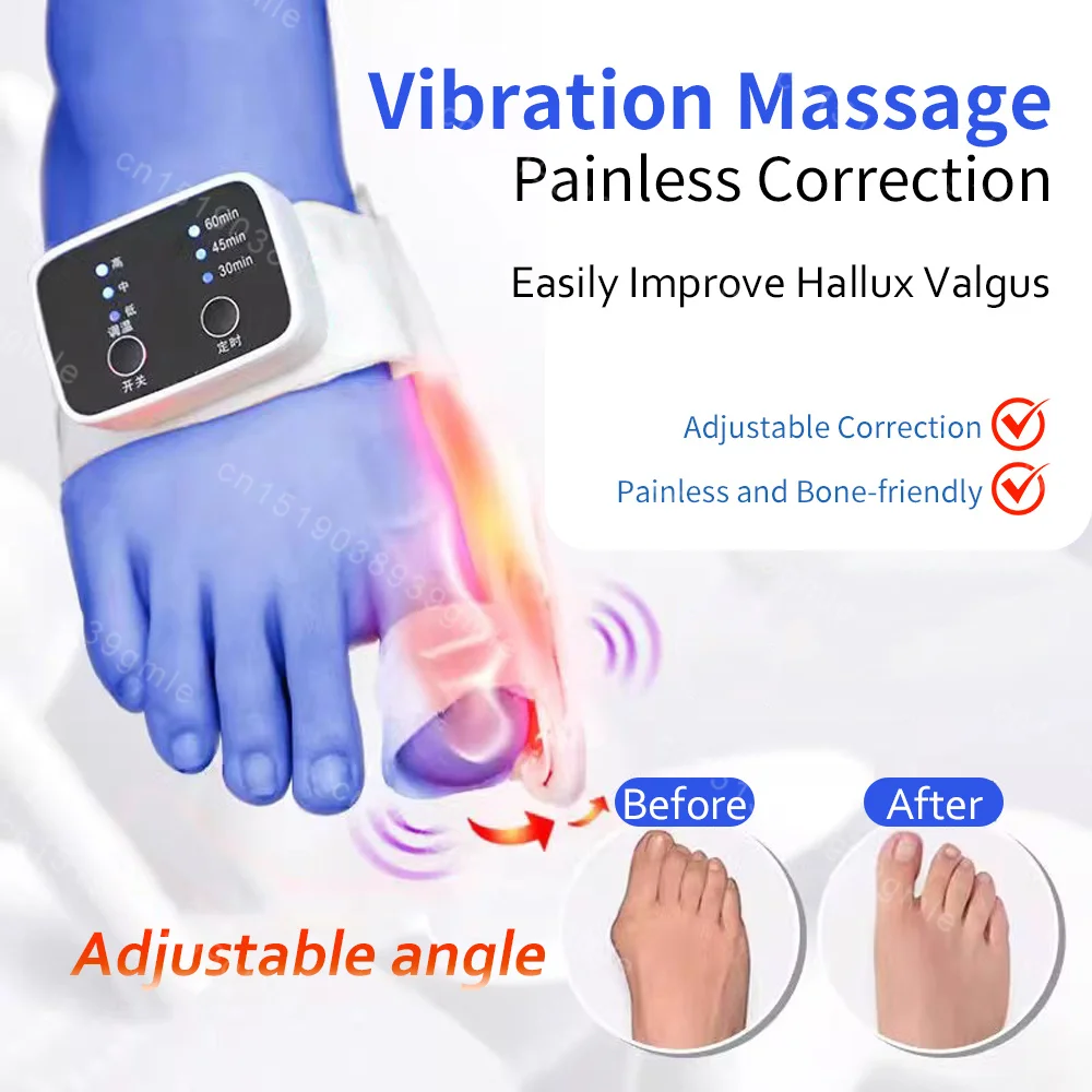 Adjustable Bunion Corrector Toe Separator Hallux Valgus Relief Toe Corrector Straightener Finger Correction Orthopedic Pedicure