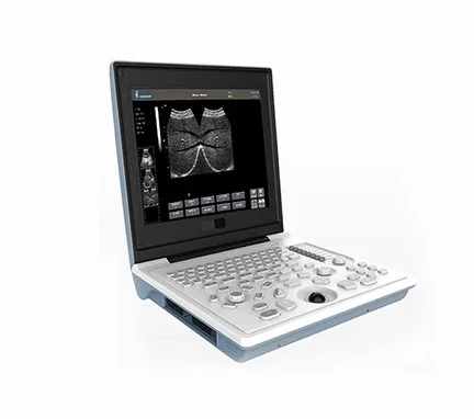 A laptop type black and white ultrasonic scanner with discounted prices