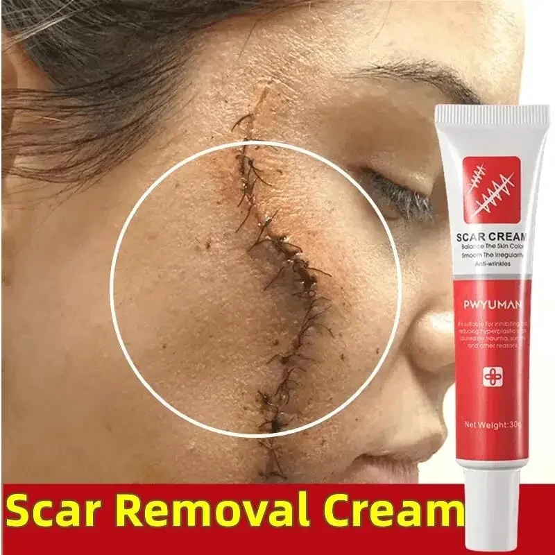 Fast Scar Removal Cream Fade Acne Spots Surgical Scar Repair Gel Stretch Marks Burn Treatment Firming Smoothing Body Skin Cares