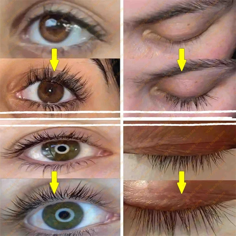 Szybkie serum na porost rzęs Naturalny wzmacniacz rzęs Dłuższe, pełniejsze, grubsze, podkręcające rzęsy Produkty do pielęgnacji oczu Makijaż