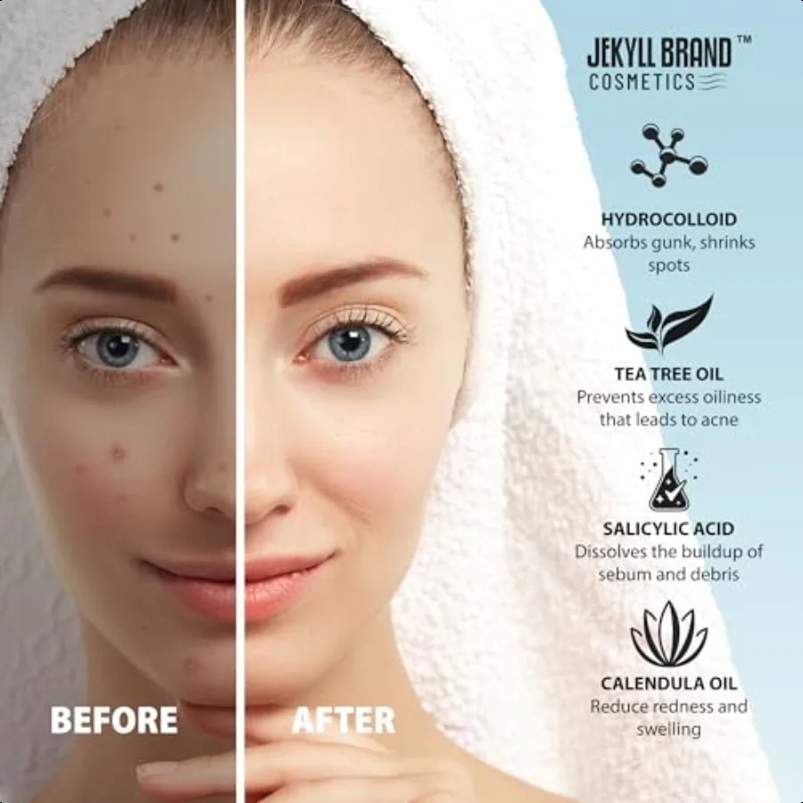 COSMETICS 턱 클렌징 패치XL 12개입 하이드로콜로이드 의료용 턱 패치 여드름 및 잡티 모공 클렌징 스트립