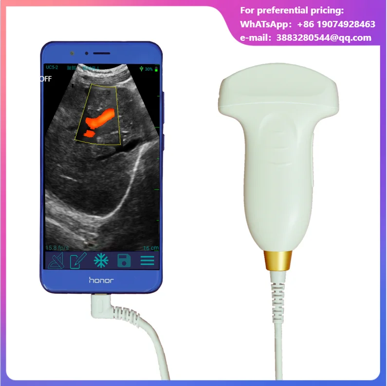 Medical Handheld Portable 128-element C-type Color Doppler Convex Usb Ultrasound Probe For Android