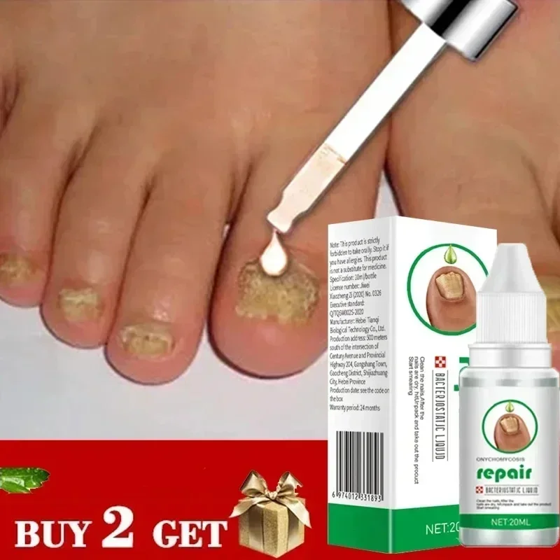 Fungal Nail Treatment Oil Foot Repair Essence Toe Nail Fungus Removal Gel Anti Infection Cream Fungal Nail Removal Paronychia