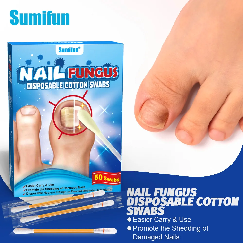 

50 одноразовых ватных тампонов с жидкостью от онихомикоза для ухода, защиты и улучшения состояния ногтей K960005