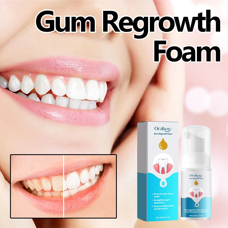 

Oralhoe Gum Foam Mousse Clean Teeth Tartar Care Gums Clean Teeth Anti-cavity Fresh Breath - Mousse 30ml