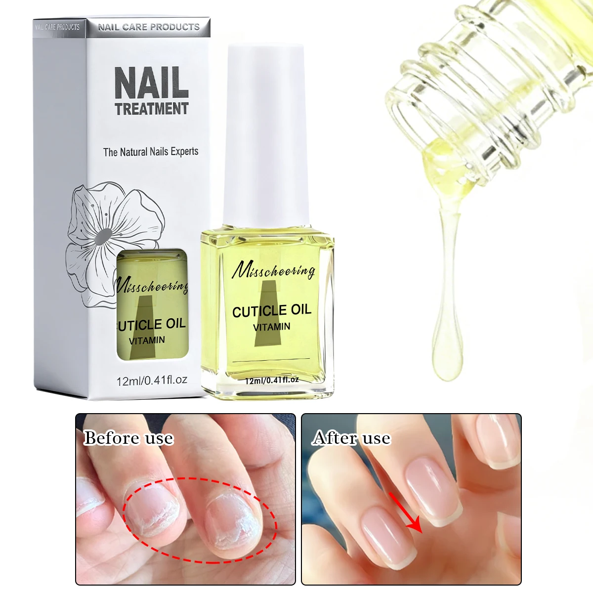 Huile nutritive pour favoriser la croissance des ongles, 12ml, pour réparer les ongles en couches douces et fines, superposition des ongles, huile de soin des ongles de haute qualité