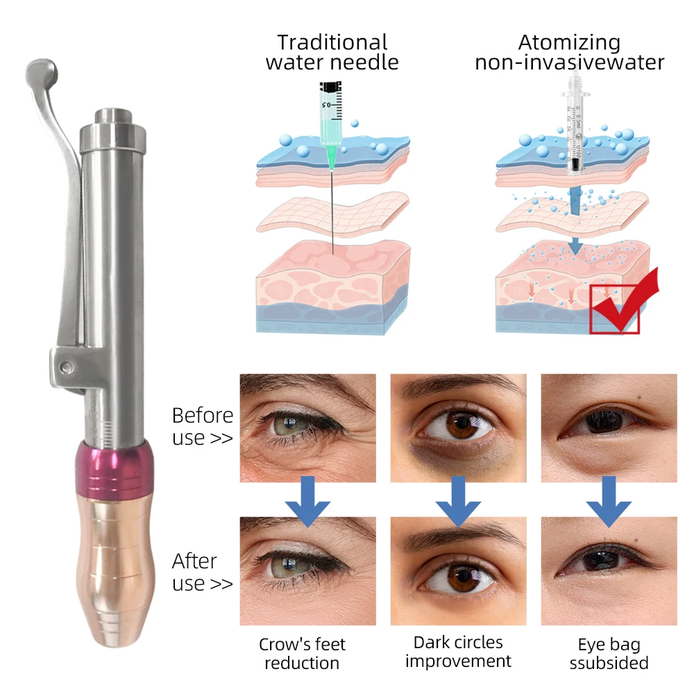 Portable 0.3ML Hyaluron Acid Pen Reduce Blemishes Wrinkles Thickening Lips Hyaluronic Acid Syringe Atomizer Pressure Pen