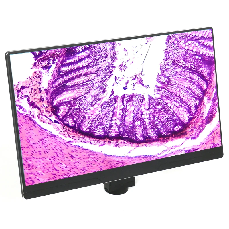 Microscope biologique numérique avec écran LCD de 10,1, 11,6 et 13,3 pouces, pour la démonstration en laboratoire, l'enseignement, l'image, la vidéo et la caméra de microscopie