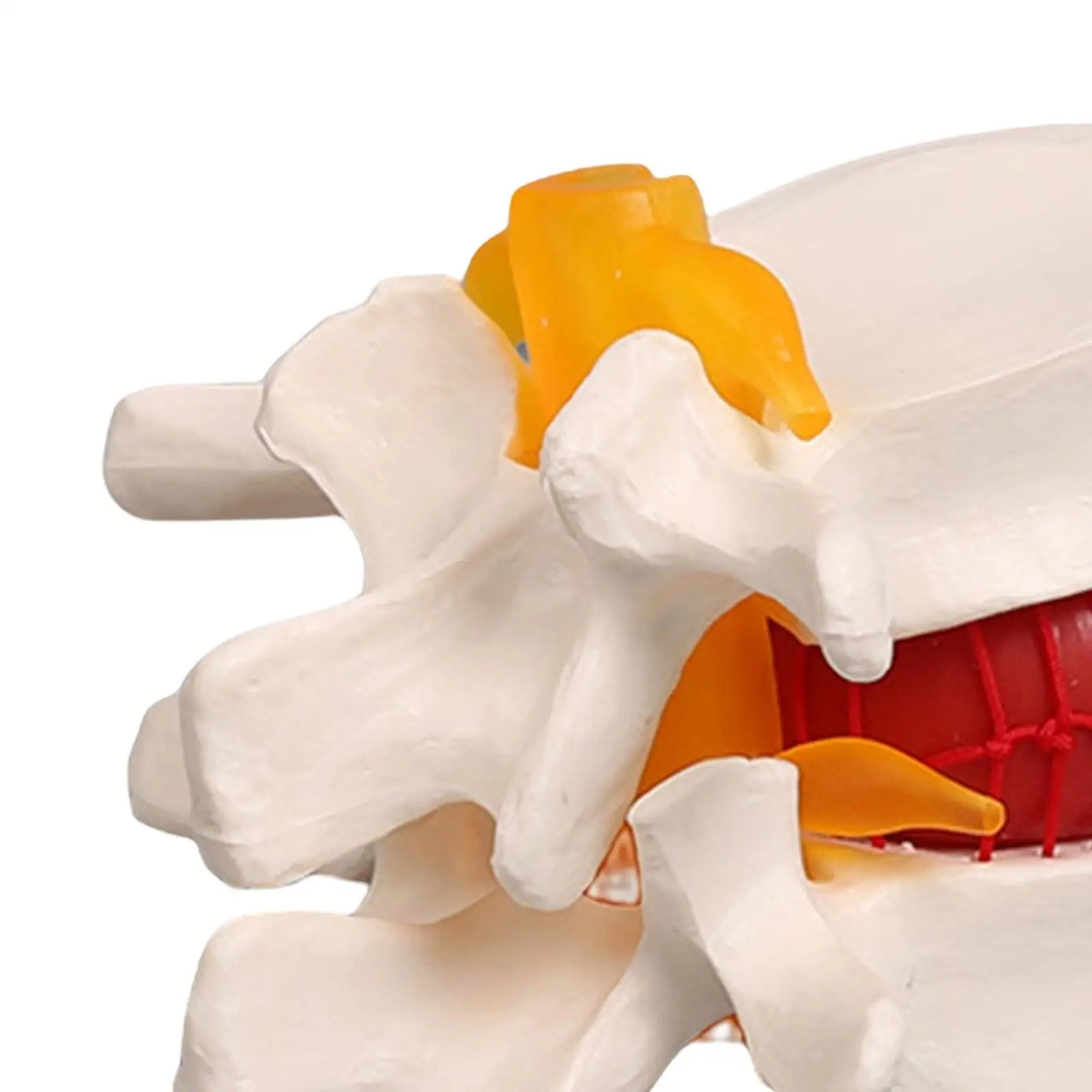 学校、人間の椎間板を教えるためのヘルニア脊椎モデル