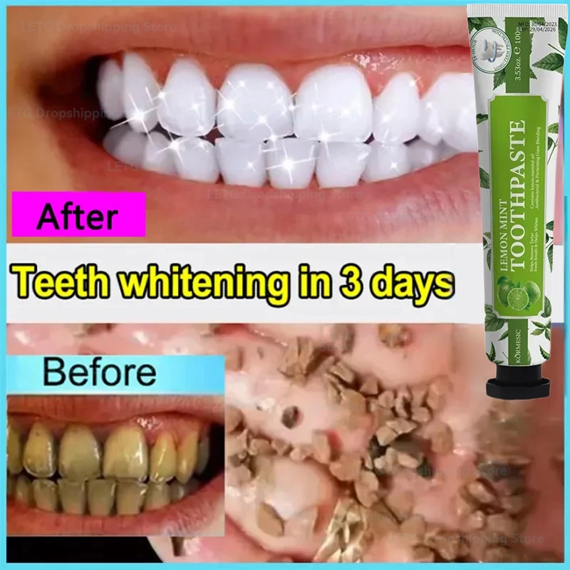 

Remover Dental Calculus Toothpaste Remove Yellow Teeth Bad Breath Cleaning Plaque Tooth Stain Whitening Preventing Periodontitis