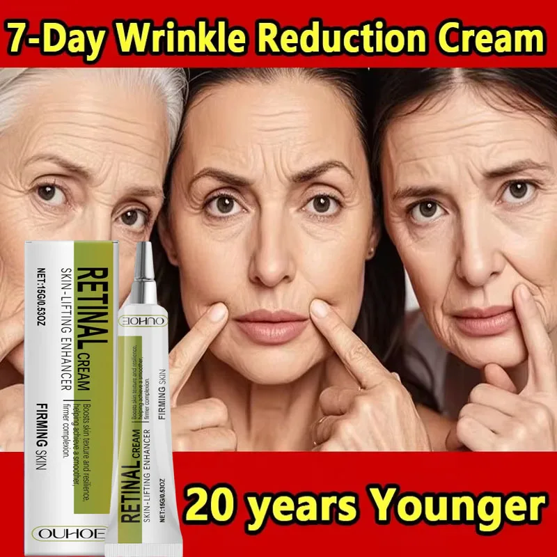 

Retinol Wrinkle Remover Face Cream Firming Lifting Anti Aging Fade Fine Lines Moisturizing Whitening Skin Care Korean Cosmetics
