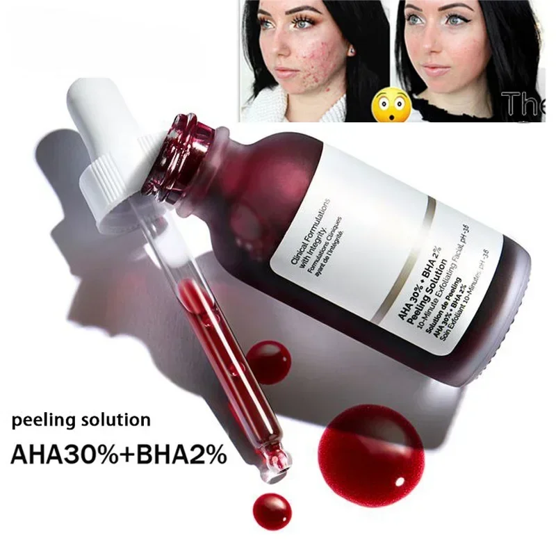 Fruit acid AHA 30% + BHA 2% exfoliating liquid facial essence salicylic acid moisturizing facial skin care products 30ml