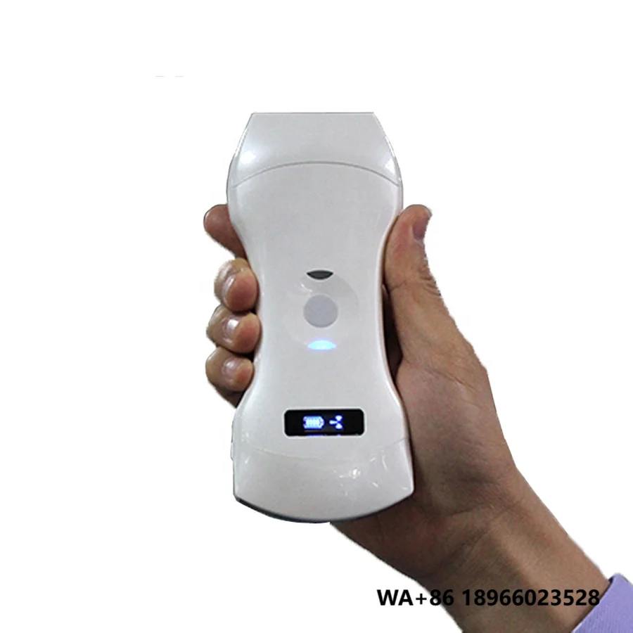3 in 1 WiFi Ultrasound Scanner Color 192 Elements Wireless Probe Medical Ultrasound for Hospital Wireless Function Included