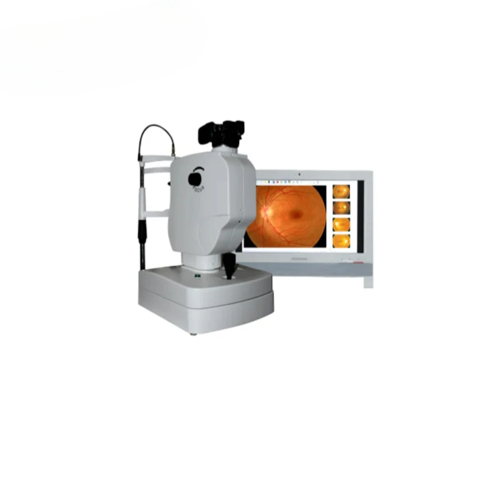 China best Medical Non-Mydriatic and mydriatic Retinal camera- LK-650A Fundus fluorescence