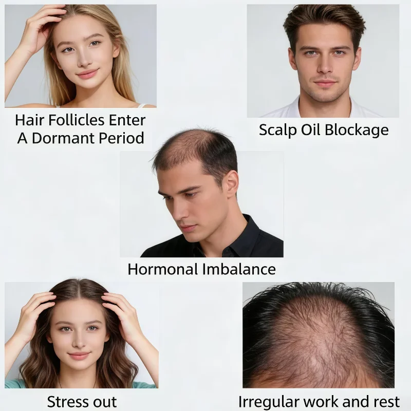 

Профессиональная беспроводная лазерная шапочка с 96 диодами, медицинская LLLT-терапия для стимуляции роста тонких волос и улучшения их здоровья