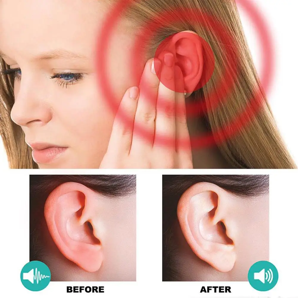 Ear Ringing Treatment Oil Deafness Earache Relieve Ear Swelling Discharge Otitis Hard Hearing Tinnitus Ear Drops 30ml