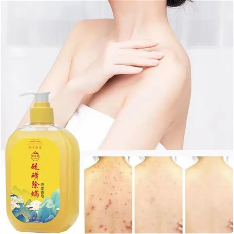 Shower Gels Sulfur Medicinal Liquid Soap Mite Removal Bath Body Wash Lotion Itching Sterilization Also Is Anti-dandruff Shampoo