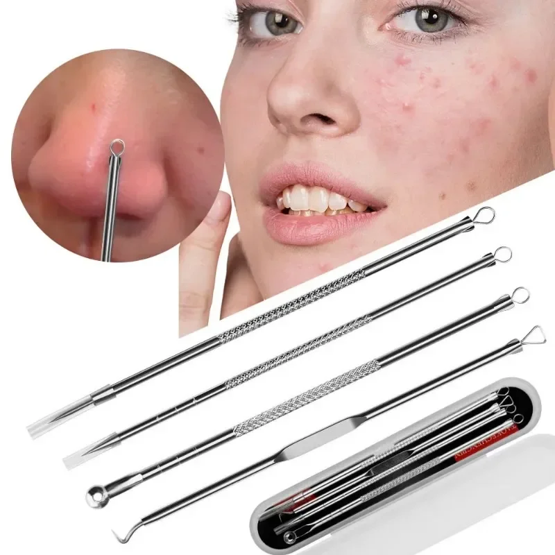 Agulha para acne, remoção de manchas de cravo, espinhas, comedone, 4 unidades, ponta dupla, aço inoxidável, limpeza facial, cuidados com a pele